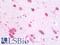 DEAH-Box Helicase 36 antibody, LS-B10068, Lifespan Biosciences, Immunohistochemistry paraffin image 