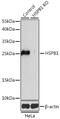 Heat Shock Protein Family B (Small) Member 1 antibody, GTX35243, GeneTex, Western Blot image 