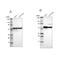 Protein Disulfide Isomerase Family A Member 3 antibody, NBP1-84796, Novus Biologicals, Western Blot image 