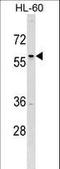 Transcription Factor AP-2 Delta antibody, LS-C157171, Lifespan Biosciences, Western Blot image 