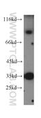 PWWP Domain Containing 3A, DNA Repair Factor antibody, 12682-1-AP, Proteintech Group, Western Blot image 