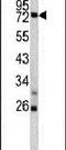 Tumor necrosis factor alpha-induced protein 2 antibody, PA5-13542, Invitrogen Antibodies, Western Blot image 