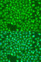 Inositol 1,4,5-Trisphosphate Receptor Type 1 antibody, 15-320, ProSci, Immunofluorescence image 