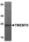 Transmembrane Protein 70 antibody, PA5-20915, Invitrogen Antibodies, Western Blot image 