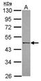 Death Associated Protein Kinase 3 antibody, GTX102404, GeneTex, Western Blot image 