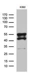 VRK Serine/Threonine Kinase 2 antibody, M04821, Boster Biological Technology, Western Blot image 