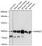 ADAM Metallopeptidase Domain 22 antibody, GTX64755, GeneTex, Western Blot image 