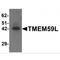 Transmembrane Protein 59 Like antibody, MBS150749, MyBioSource, Western Blot image 