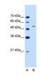 Nicotinamide Phosphoribosyltransferase antibody, orb324988, Biorbyt, Western Blot image 