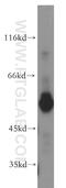 ST3 Beta-Galactoside Alpha-2,3-Sialyltransferase 6 antibody, 13154-1-AP, Proteintech Group, Western Blot image 
