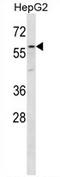 Zona Pellucida Glycoprotein 4 antibody, AP54737PU-N, Origene, Western Blot image 