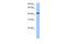 Ring Finger Protein, Transmembrane 2 antibody, PA5-43500, Invitrogen Antibodies, Western Blot image 