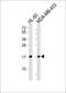 Fragile Histidine Triad Diadenosine Triphosphatase antibody, M01200-1, Boster Biological Technology, Western Blot image 
