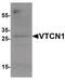 V-Set Domain Containing T Cell Activation Inhibitor 1 antibody, PA5-34501, Invitrogen Antibodies, Western Blot image 