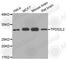 TPD52 Like 2 antibody, A4165, ABclonal Technology, Western Blot image 