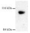 Dynamin 3 antibody, GTX23458, GeneTex, Western Blot image 