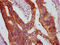 KRIT1 Ankyrin Repeat Containing antibody, LS-C680745, Lifespan Biosciences, Immunohistochemistry paraffin image 