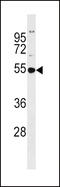 Glutathione Synthetase antibody, 62-525, ProSci, Western Blot image 