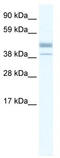 Estrogen Related Receptor Beta antibody, TA329374, Origene, Western Blot image 