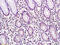 Autoimmunogenic cancer/testis antigen NY-ESO-2 antibody, GTX51753, GeneTex, Immunohistochemistry paraffin image 