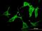 P21 (RAC1) Activated Kinase 3 antibody, H00005063-M07, Novus Biologicals, Immunofluorescence image 