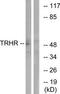 Thyrotropin Releasing Hormone Receptor antibody, TA314641, Origene, Western Blot image 