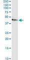 Serpin Family A Member 12 antibody, H00145264-M01, Novus Biologicals, Immunoprecipitation image 