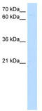 Zinc Finger With KRAB And SCAN Domains 1 antibody, TA342429, Origene, Western Blot image 