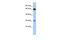 Chromosome 6 Open Reading Frame 223 antibody, PA5-44379, Invitrogen Antibodies, Western Blot image 