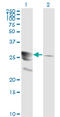 GTP Cyclohydrolase 1 antibody, LS-C133216, Lifespan Biosciences, Western Blot image 