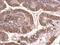 Tubulin Beta 2A Class IIa antibody, GTX100117, GeneTex, Immunohistochemistry paraffin image 