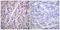A-Raf Proto-Oncogene, Serine/Threonine Kinase antibody, LS-C198640, Lifespan Biosciences, Immunohistochemistry frozen image 