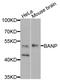 BTG3 Associated Nuclear Protein antibody, STJ29732, St John