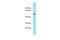 Potassium Voltage-Gated Channel Subfamily J Member 16 antibody, PA5-68682, Invitrogen Antibodies, Western Blot image 