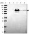 Coagulation Factor II, Thrombin antibody, NBP2-33617, Novus Biologicals, Western Blot image 