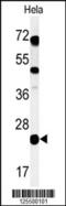 Chromosome 16 Open Reading Frame 54 antibody, 61-652, ProSci, Western Blot image 