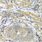Protein Interacting With PRKCA 1 antibody, A1519, ABclonal Technology, Immunohistochemistry paraffin image 