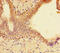 SPT3 Homolog, SAGA And STAGA Complex Component antibody, A54487-100, Epigentek, Immunohistochemistry paraffin image 