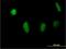 MSL Complex Subunit 3 antibody, H00010943-B01P, Novus Biologicals, Immunocytochemistry image 