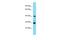 LHFPL Tetraspan Subfamily Member 3 antibody, A16275, Boster Biological Technology, Western Blot image 