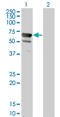 5'-Nucleotidase, Cytosolic II antibody, LS-C133696, Lifespan Biosciences, Western Blot image 