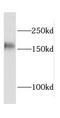 Cleavage And Polyadenylation Specific Factor 1 antibody, FNab01936, FineTest, Western Blot image 