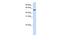 Transcriptional Adaptor 3 antibody, PA5-40594, Invitrogen Antibodies, Western Blot image 