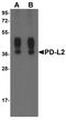 Cd273 antibody, TA355062, Origene, Western Blot image 