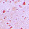 T-Box 22 antibody, LS-C354175, Lifespan Biosciences, Immunohistochemistry frozen image 