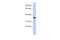 CPX Chromosome Region Candidate 1 antibody, 25-550, ProSci, Western Blot image 