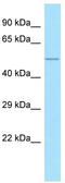 ALG10 Alpha-1,2-Glucosyltransferase antibody, TA331308, Origene, Western Blot image 