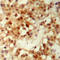 Forkhead Box O3 antibody, LS-C368596, Lifespan Biosciences, Immunohistochemistry paraffin image 