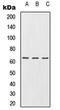 Unconventional prefoldin RPB5 interactor antibody, orb214823, Biorbyt, Western Blot image 