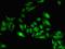 SET Domain Containing 5 antibody, orb37223, Biorbyt, Immunofluorescence image 